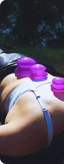 Cupping therapy session